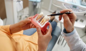 Dentiste montrant un modèle d'implants à une patiente