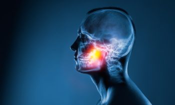 Radiographie des articulations temporo-mandibulaires