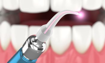 Illustration 3D d'un laser chirurgical