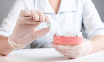 Dentistes tenant une maquette de bouche en bois avec une dent manquante.