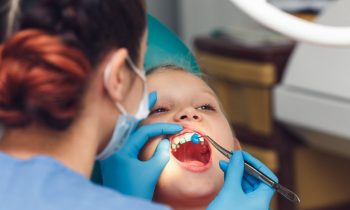 Application de fluor sur les dents d'une enfant